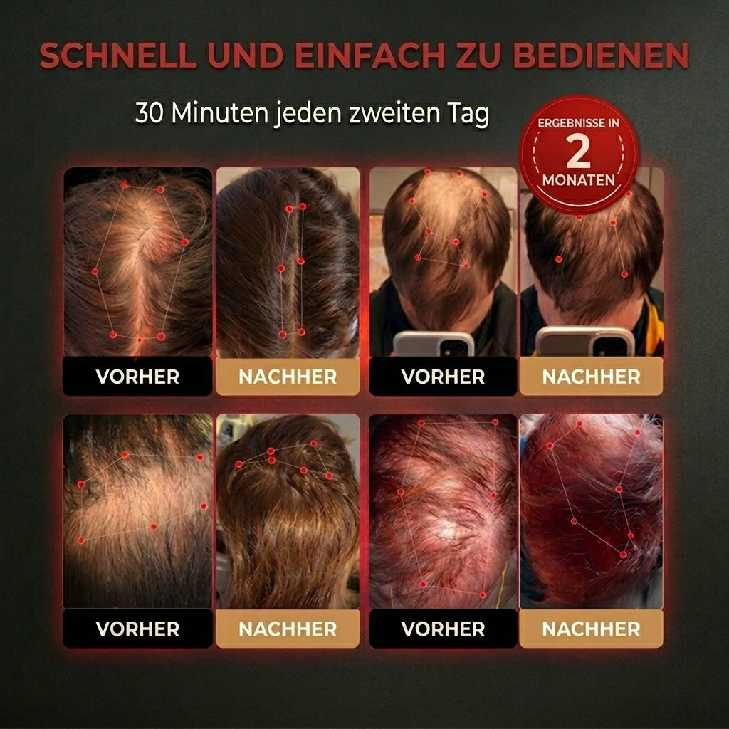 HairGrowth Cap