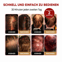 120 LED Haarwachstums-Cap™